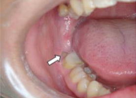 口腔外科 小田原市 開成町 松田町 秦野市 大井町 めぐみ歯科医院 小田原市 開成町 松田町 秦野市 大井町の歯科