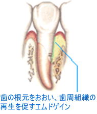 エムドゲイン