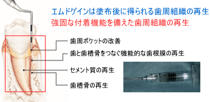 エムドゲイン