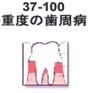 重度の歯周病