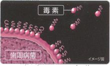 図解