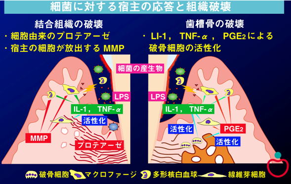組織破壊