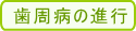 歯周病の進行